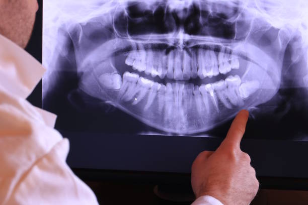 Best Emergency Dental Care for Abscessed Tooth in Southern Pines, NC