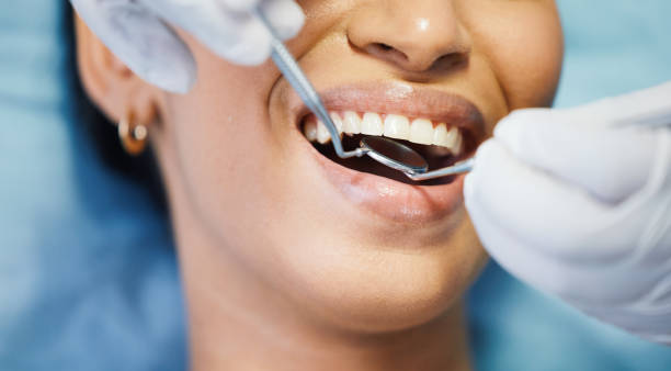 Best Emergency Dentist for Lost Fillings or Crowns in Southern Pines, NC