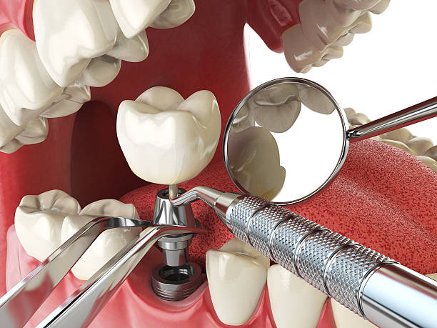 Best Weekend Emergency Dentist in Southern Pines, NC